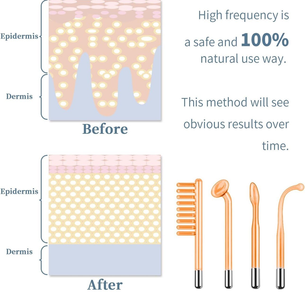 Appareil à haute fréquence|Machine faciale|Stimulation des racines|Santé|TUMAKOU